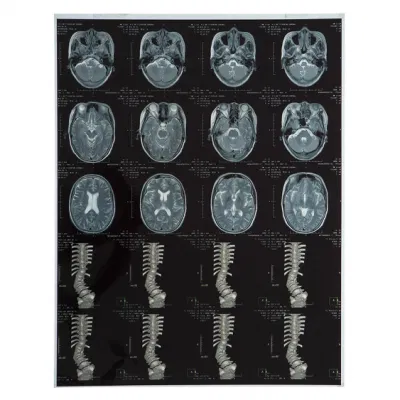 X Ray Medical Dry Film X
