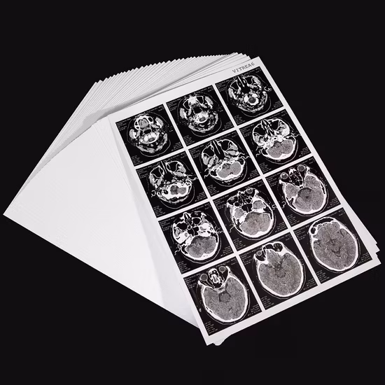 Medical Dry X Ray Film for Hospitals in China