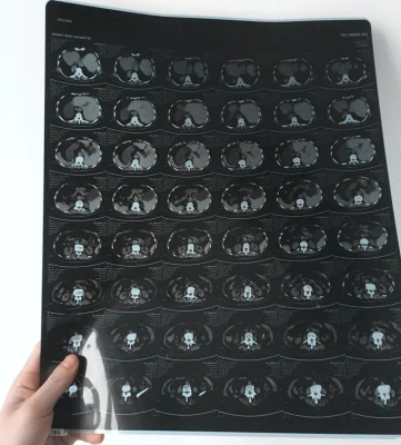 MRI Using Inkjet Dry Medical X