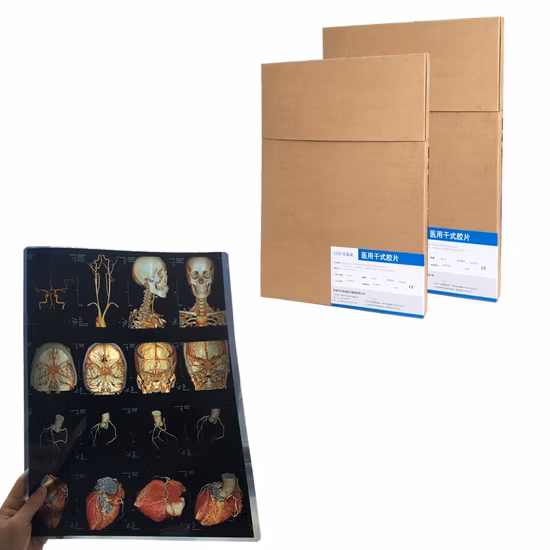 Printable Inkjet Image Media Advertising Materials Pet Matte Backlit Film